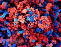 trung quoc phat trien vat lieu nano phong chong virus sars cov 2